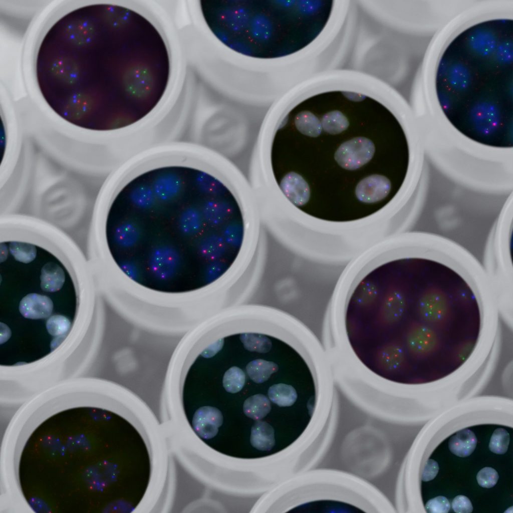 Fundación Innovación Bankinter - Medicina personalizada