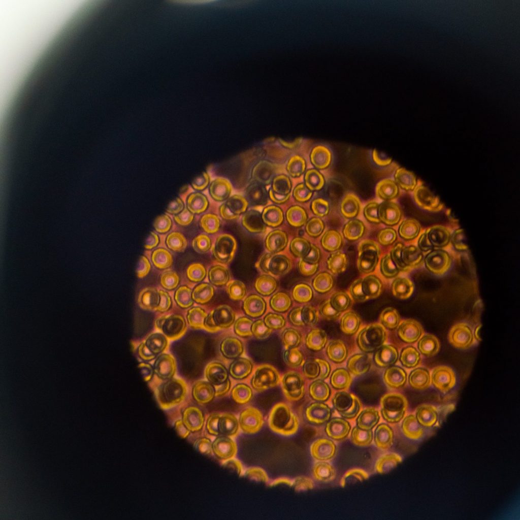 Terapias genéticas orientadas: cómo afinar la última milla de la medicina