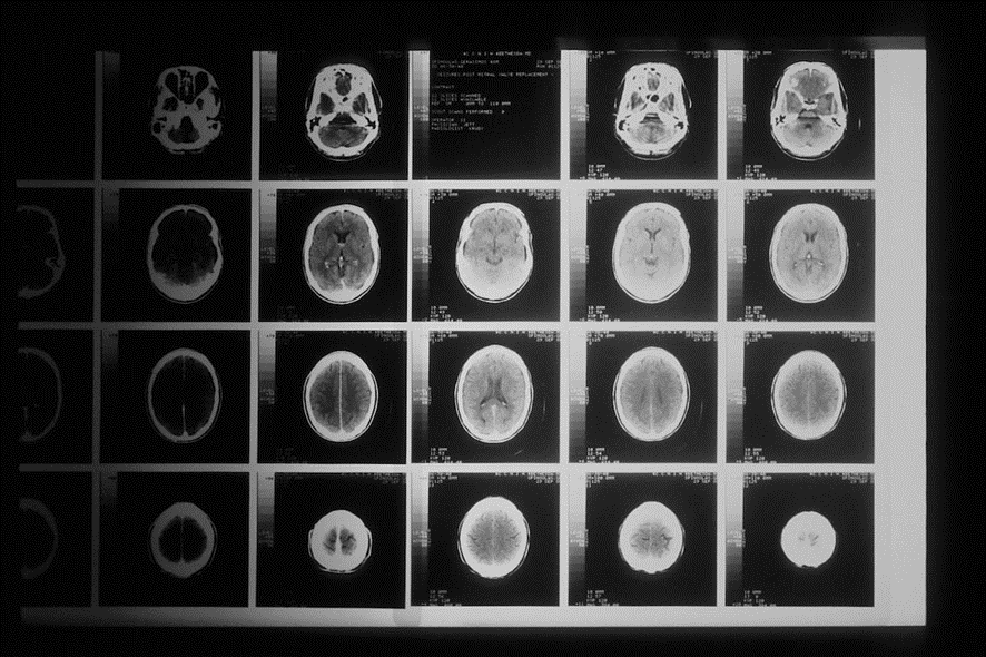 Why can't we see the brain in real time without invasive mechanisms