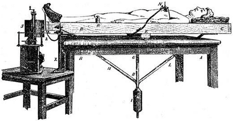Alex Fornito recounted that the first technique for measuring brain function was created in 1882